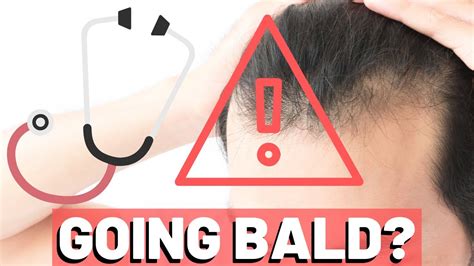 male bald pornstars|How to know if (and when) you’re going to go bald .